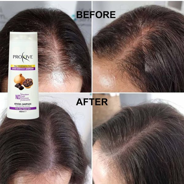PROXIVE Anti-Hair Loss Herbal Black Garlic Shampoo - Image 4