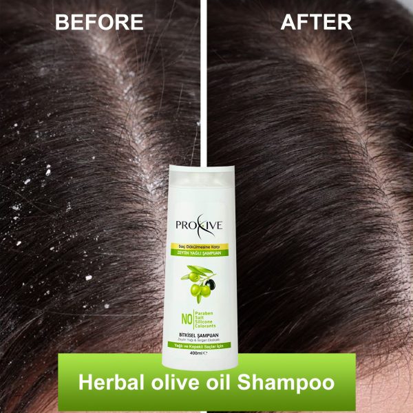 PROXIVE Anti-Hair Loss Herbal Olive Oil Shampoo - Image 4